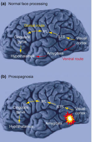 Image:Ellis-fig3.jpg